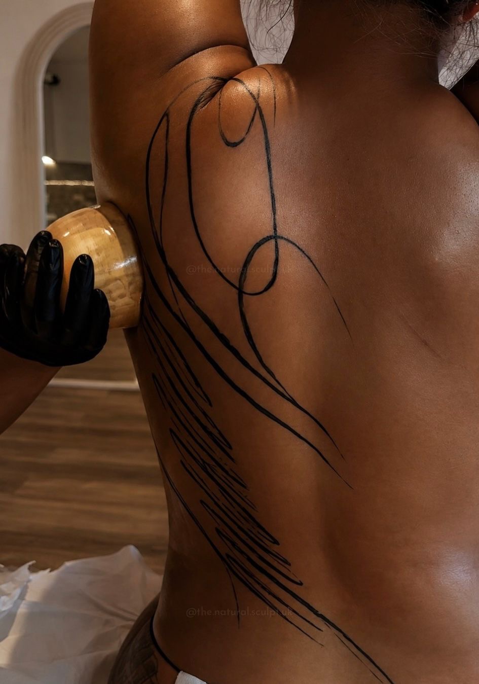 Practitioner using a wooden tool along mapped treatment lines during a recovery session